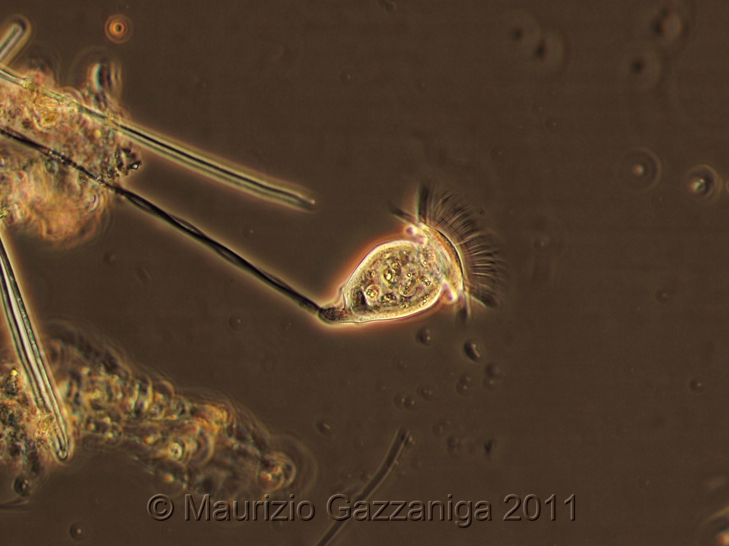 Vorticella in contrasto di fase.